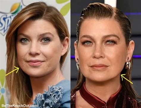 ellen pompeo lip fillers|Ellen Pompeo Plastic Surgery Comparison Photos .